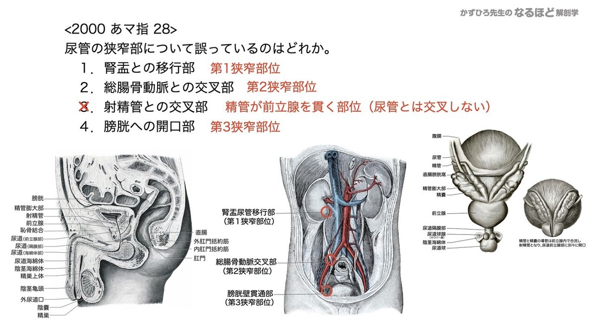 【徹底的国試対策】5-2 泌尿器系 - 尿管・膀胱・尿道.083