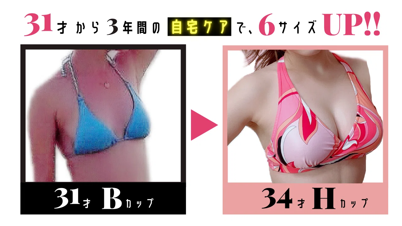 ふわふわの柔らかいボリュームバストになる おっぱいマッサージで 31歳でもb Hカップにバストアップ成功 美胸チャレンジ Day16 アラサーでb Hカップ かなえ先生 美胸マッサージ Note
