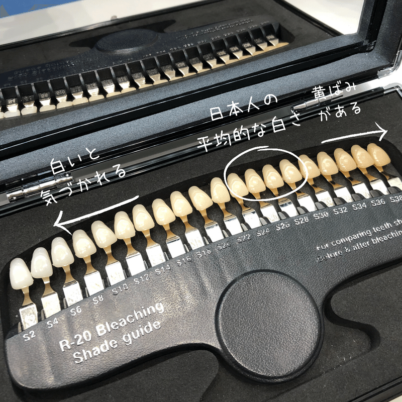 ホワイトニング平均