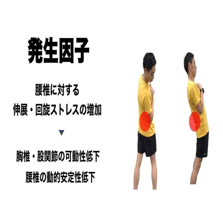 スポーツ復帰に向けた腰椎分離症に対するアプローチ L Fit Note