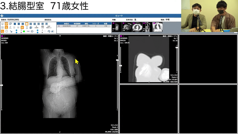 第7回 LOOKREC画像診断勉強会 - 消化管の読影（正常編）-0009