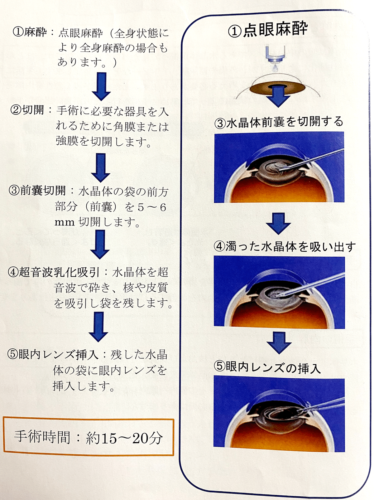 手術内容