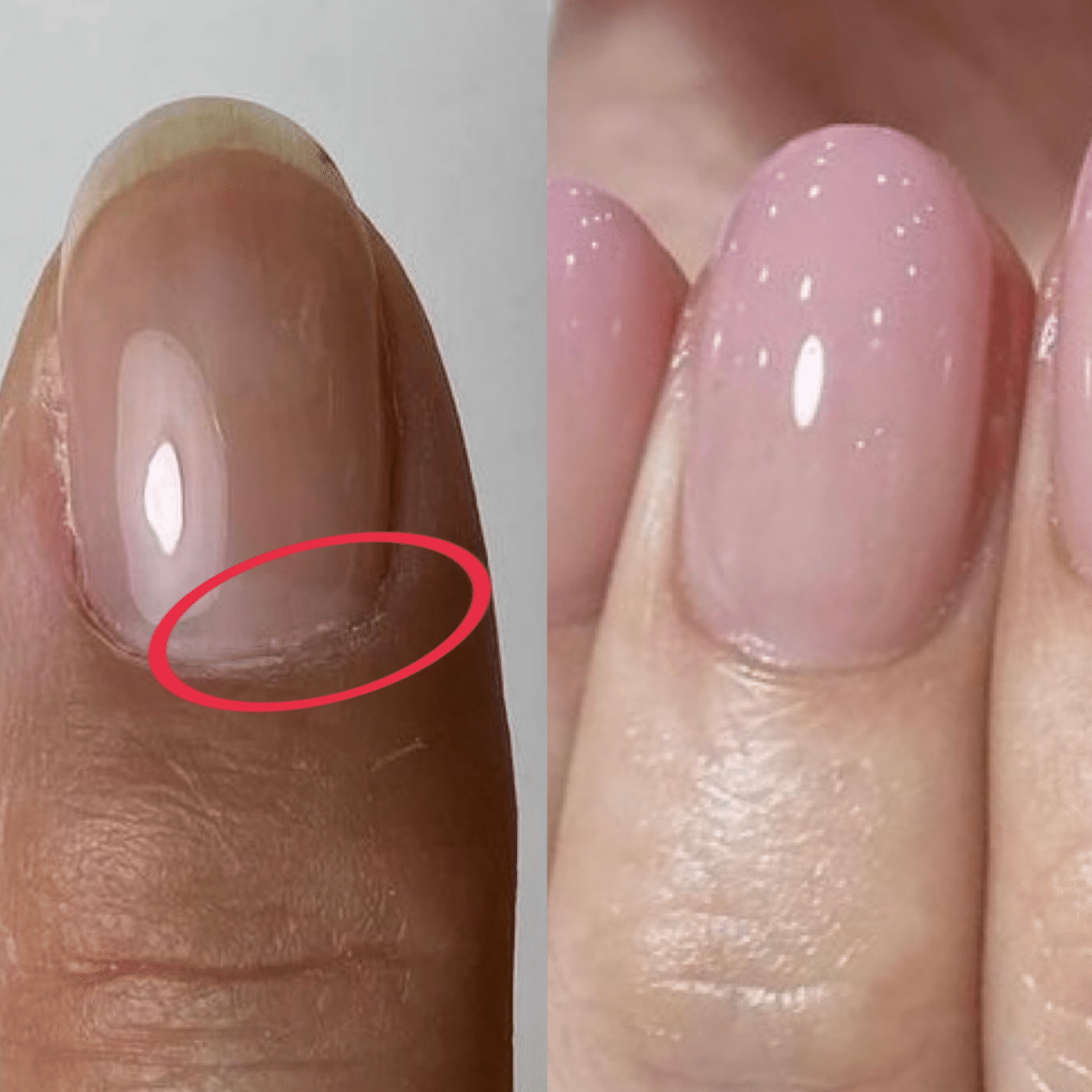 カウンセリング企画後半戦 徹底的に分析していきます Maonailofficial Note カウンセリング企画後半戦 徹底的に分析していきます Maonailofficial Note