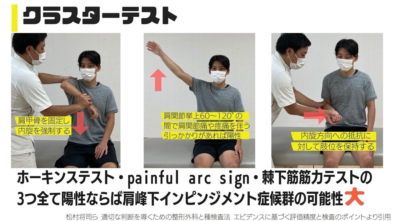 肩峰下インピンジメントに対する整形外科的テストの捉え方 動画解説 江尻 廣樹 Note