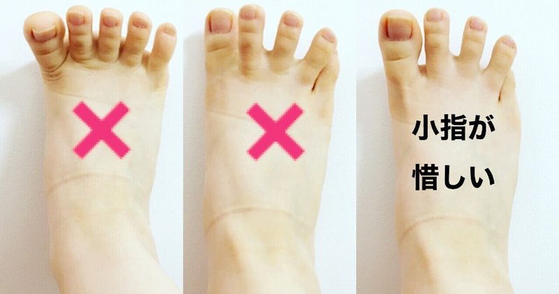 浮き指 の新着タグ記事一覧 Note つくる つながる とどける 浮き指 の新着タグ記事一覧 Note つくる つながる とどける