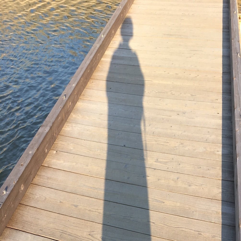 脱毛症の私がスキンヘッドになって カミングアウトするまで ズきゅ Note