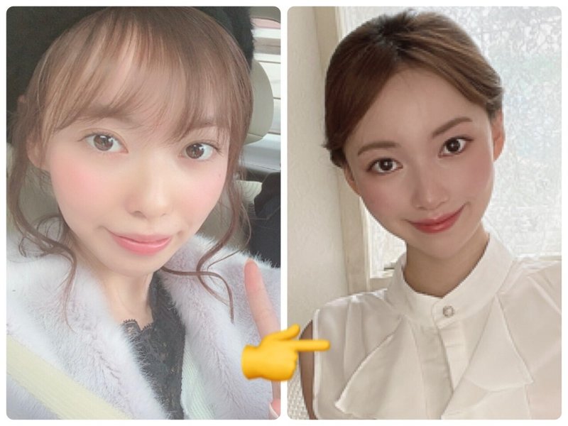 歯列矯正で口元もっこり 口元を綺麗にするには 筋肉と思考パターンの関係性 水紀華 Note 歯列矯正で口元もっこり 口元を綺麗にするには 筋肉と思考パターンの関係性 水紀華 Note
