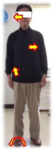形態構築アプローチって何？｜土屋元明｜理学療法士／動きの
