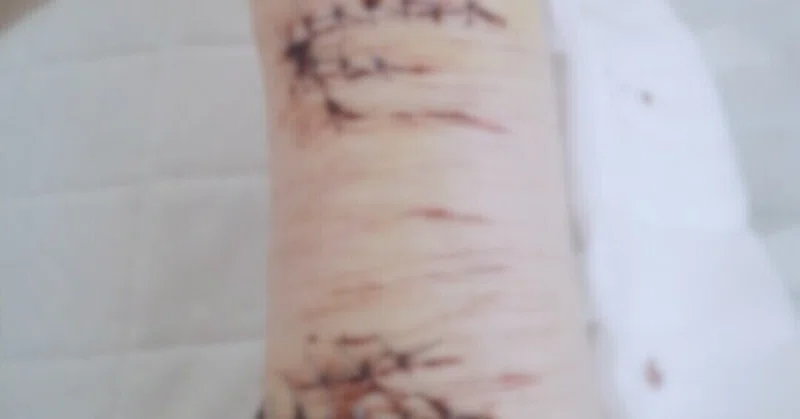 リスカちゃん 消えないで 閲覧者注意だよ めんびちゃん Note