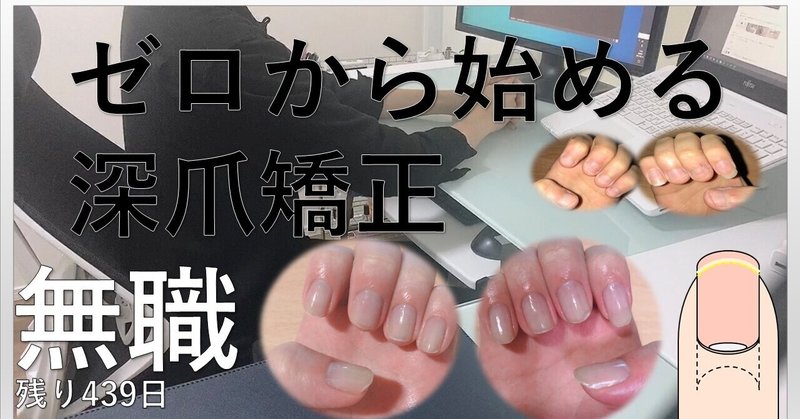 深爪矯正 の新着タグ記事一覧 Note つくる つながる とどける 深爪矯正 の新着タグ記事一覧 Note つくる つながる とどける