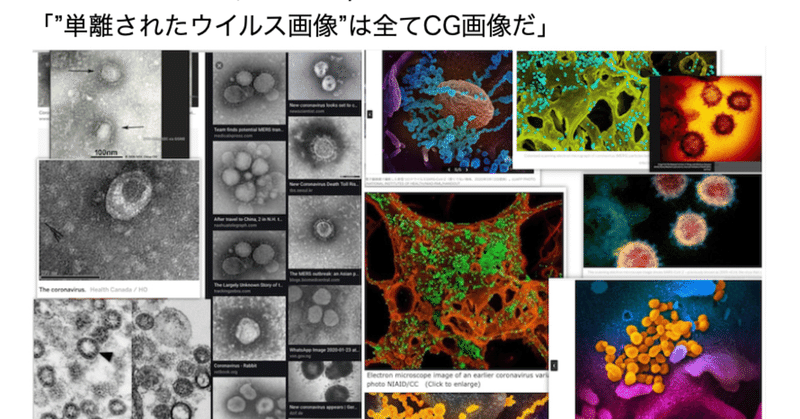 インフルエンザはどこへ行った？ 【現代医学の常識を疑う】