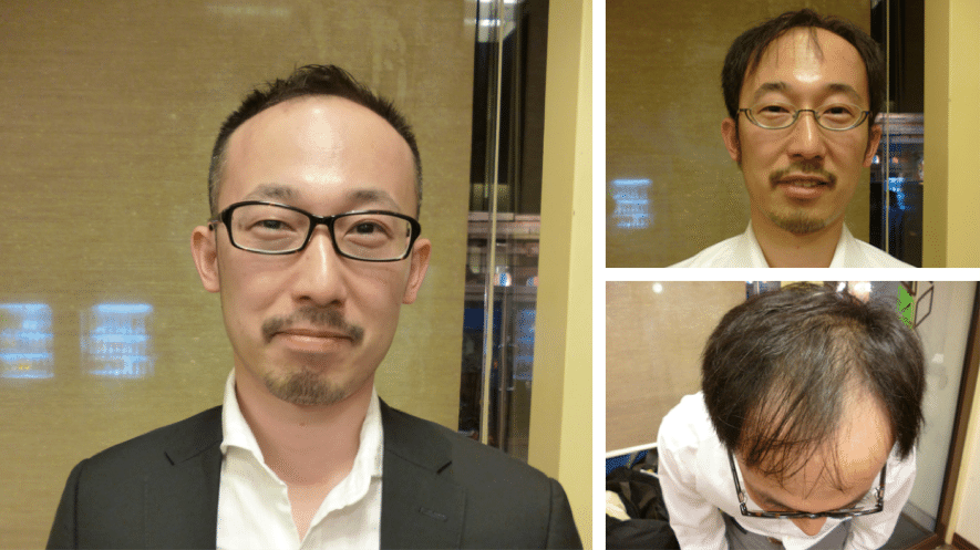 どうすれば カッコいいハゲ になれるのかを真剣に考察した べー Note どうすれば カッコいいハゲ になれるのかを真剣に考察した べー Note