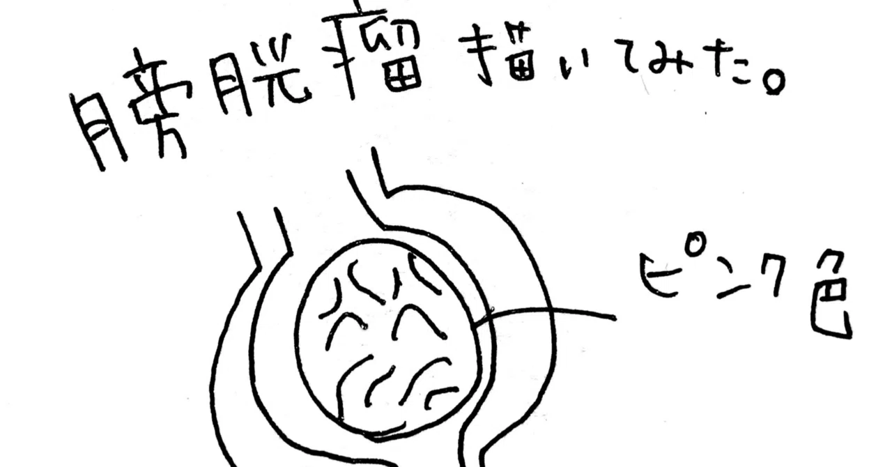 骨盤臓器脱」の新着タグ記事一覧｜note u2015u2015つくる、つながる、とどける。