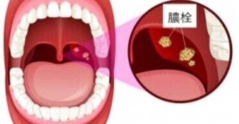 臭い玉 Uebayashi Note