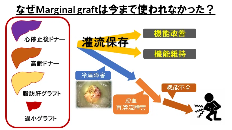 日本の臓器移植治療に未来はあるのか？世界の最先端と比較し正直に考察