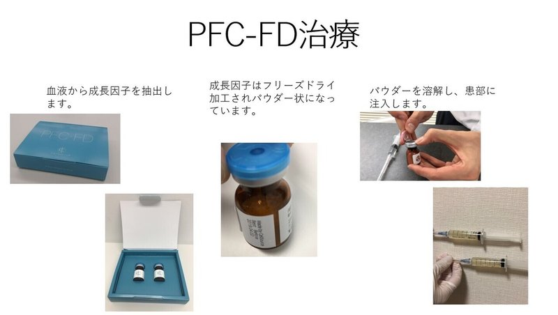 PFC-FD注入E38080患者様説明用.pptx-1