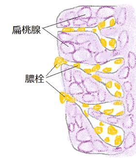 臭い玉 Uebayashi Note