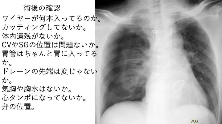 胸部大動脈の外科　大北裕 胸部大動脈の外科[Web動画付] | 大北裕 |本 | 通販 | Amazon