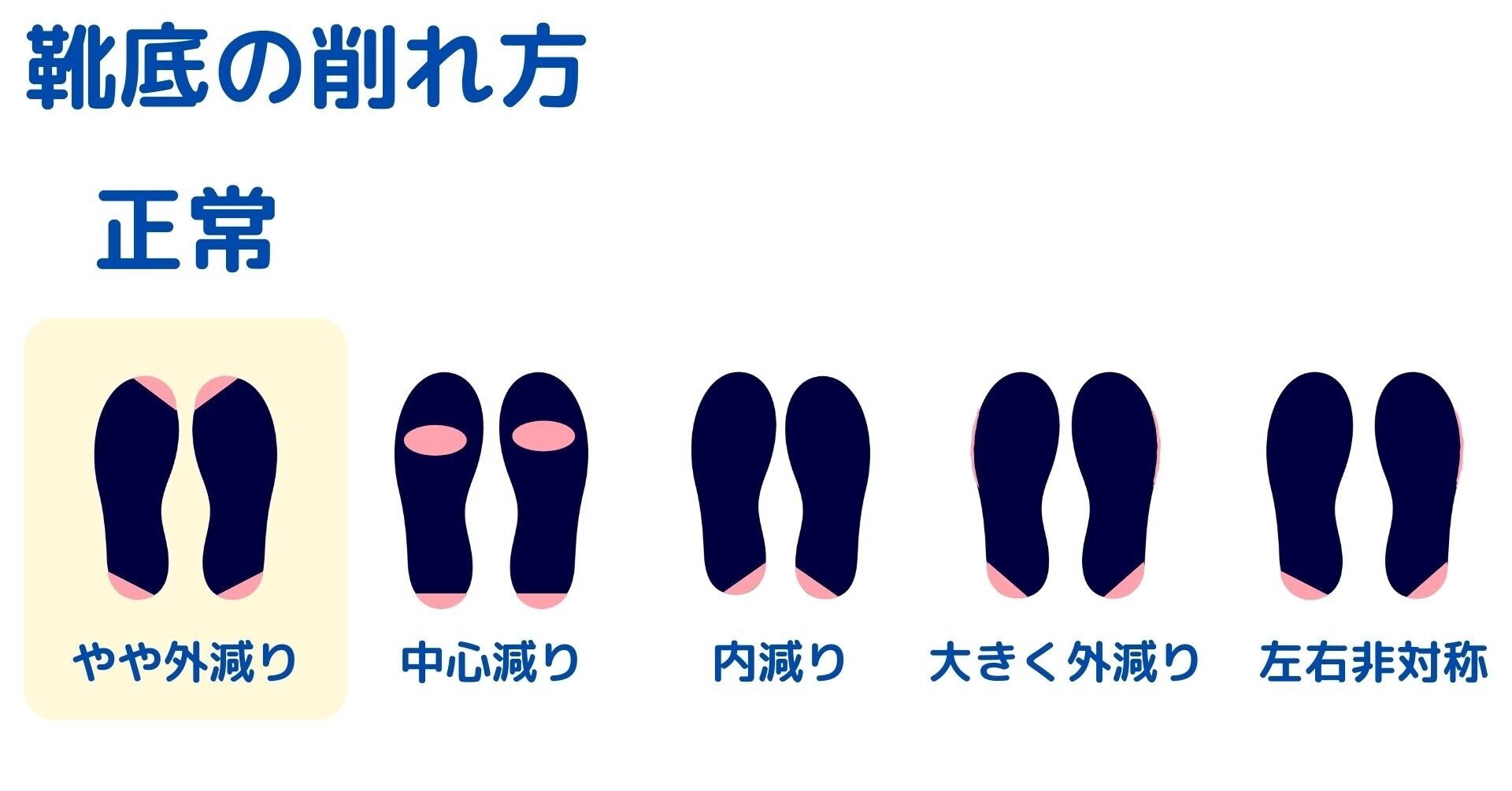 意外と知らない常識 靴のカカトが斜めにすり減るのは正常だという事 コバ靴店 こば Note