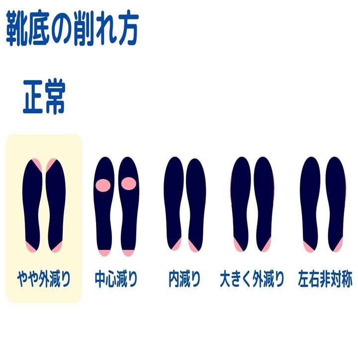 意外と知らない常識 靴のカカトが斜めにすり減るのは正常だという事 こば Note