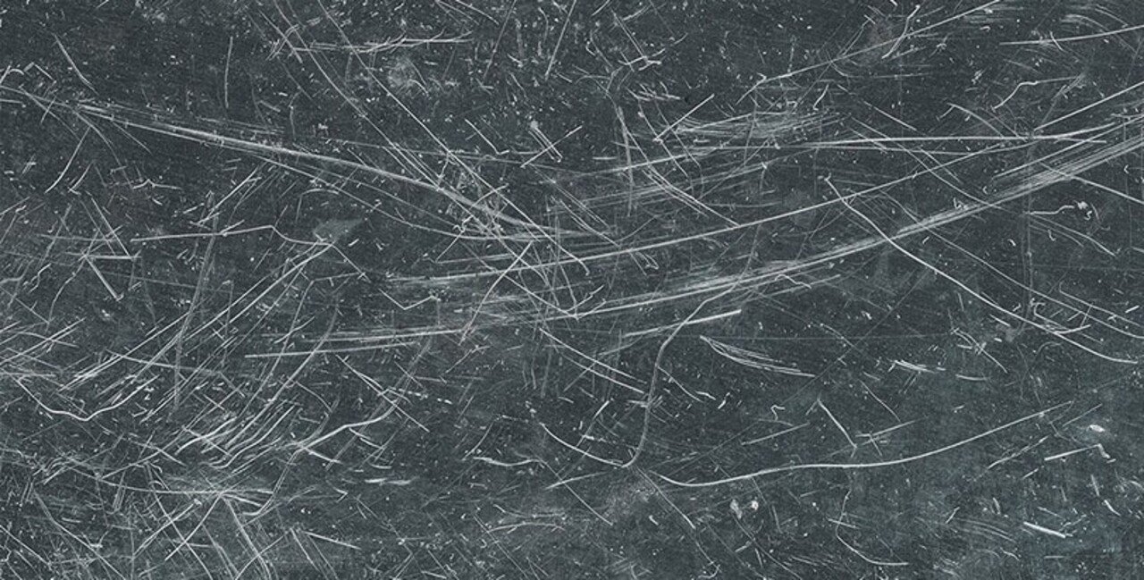 親が僕につけた 癒えない傷 れいや Note 親が僕につけた 癒えない傷 れいや Note