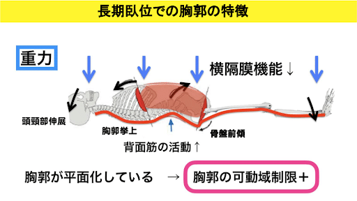 長期臥位での胸郭の特徴