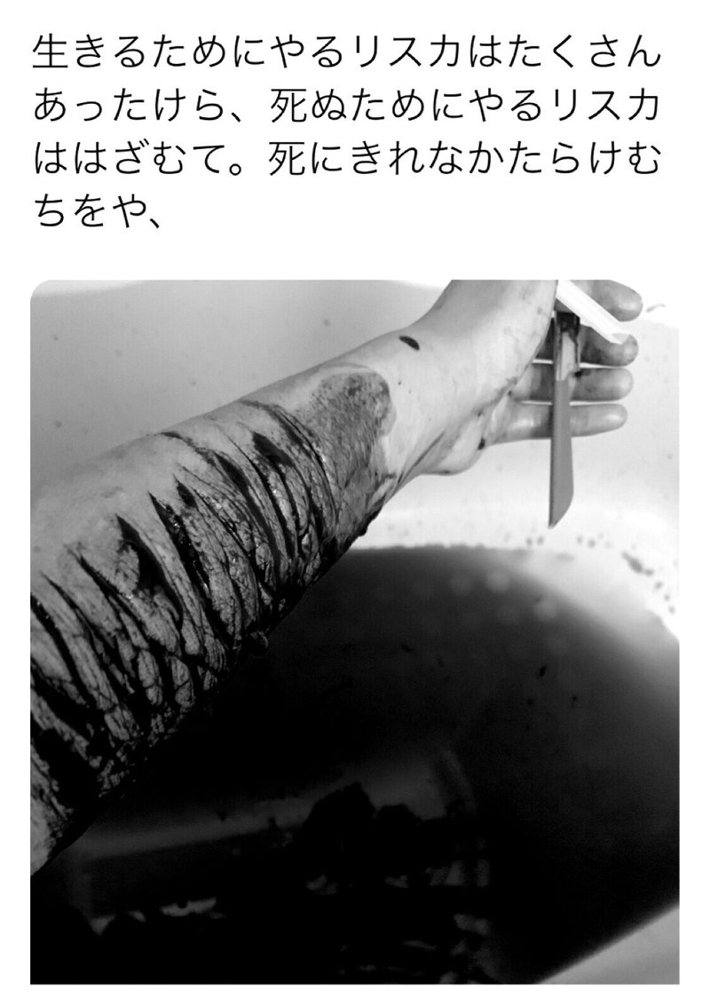 辛い人生より死を選ぶ 悟りちゃん Note 辛い人生より死を選ぶ 悟りちゃん Note
