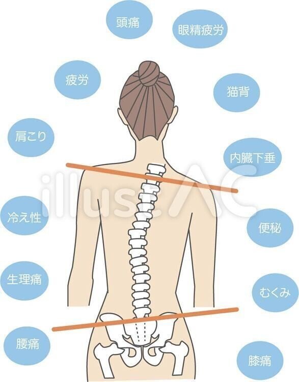 New Style イラストフリー素材 骨盤の歪みと体の不調 無料 イラスト無料提供中 一部有料 Note