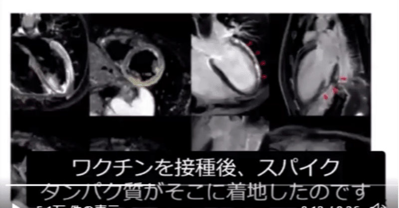 【毒ワクチン、完全に否定されてますが?死にますよ、欠陥品】「本日のFDAワクチン会議の速報、専門家のコメント。
・有害事象報告データから、(ワクチン接種の)リスクがベネフィットを大きく上回っている、特に子供には
・2021年の有害事象報告は1000%増
・接種が変異を促している疑い
・製品(ワクチン)は明らかに失敗」