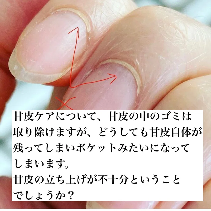 セルフネイラー向けマオ塾補習 皆さま皮膚を切りすぎてはいませんか あなたが切っているのは皮膚 それってネイルが浮く 原因となる場所でしょうか Maonailofficial Note