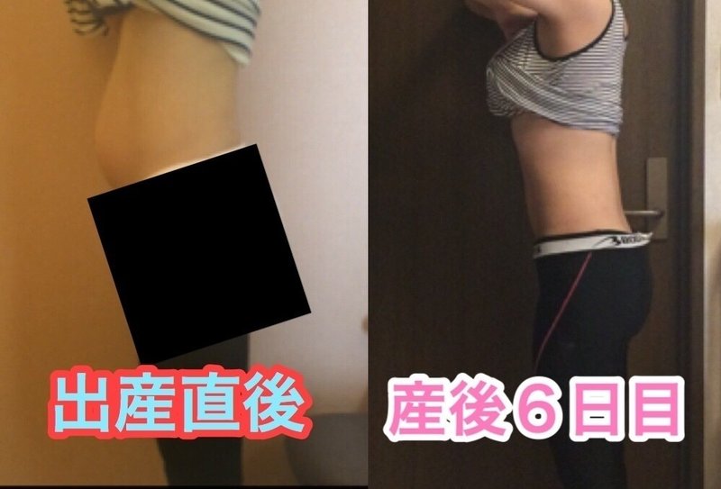 出産直後 6日目までのお腹の変化 画像あり 母ちゃんトレーナーyukina Note 出産直後 6日目までのお腹の変化 画像あり 母ちゃんトレーナーyukina Note