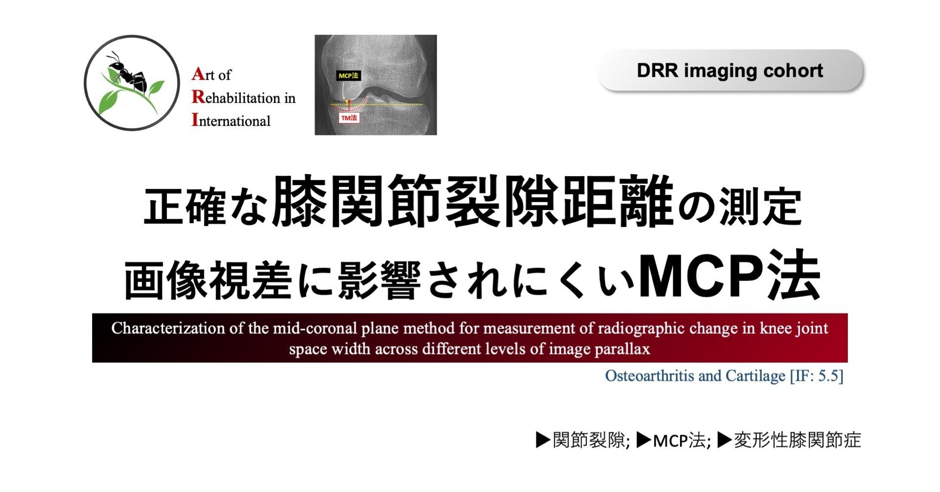 正確な膝関節裂隙距離の測定：画像視差に影響されにくいMCP法