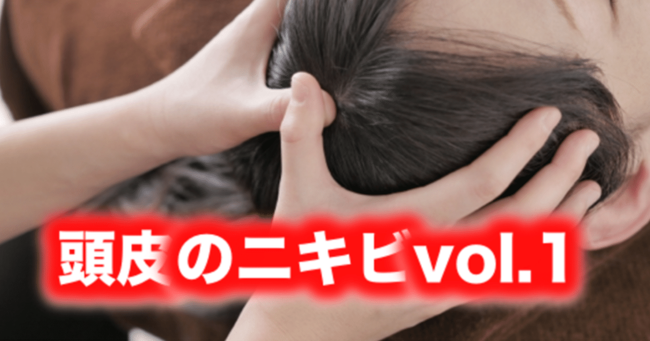 頭皮のニキビvol 1 片柳ちひろ ニキビ博士 Note