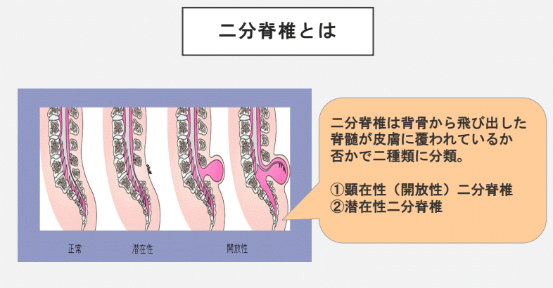 無題1