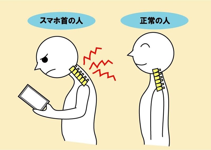 スマホ首 ストレートネック