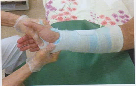 橈骨遠位端骨折を診る上で必要な知識⑥保存VS手術｜小林 博樹