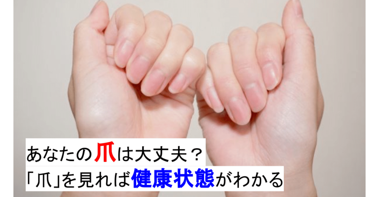 文系 医療 あなたの爪は大丈夫 爪 を見れば健康状態が分かる しょーた 文系の 医師国家試験 勉強日記 Note 文系 医療 あなたの爪は大丈夫 爪 を見れば健康状態が分かる しょーた 文系の 医師国家試験 勉強日記 Note