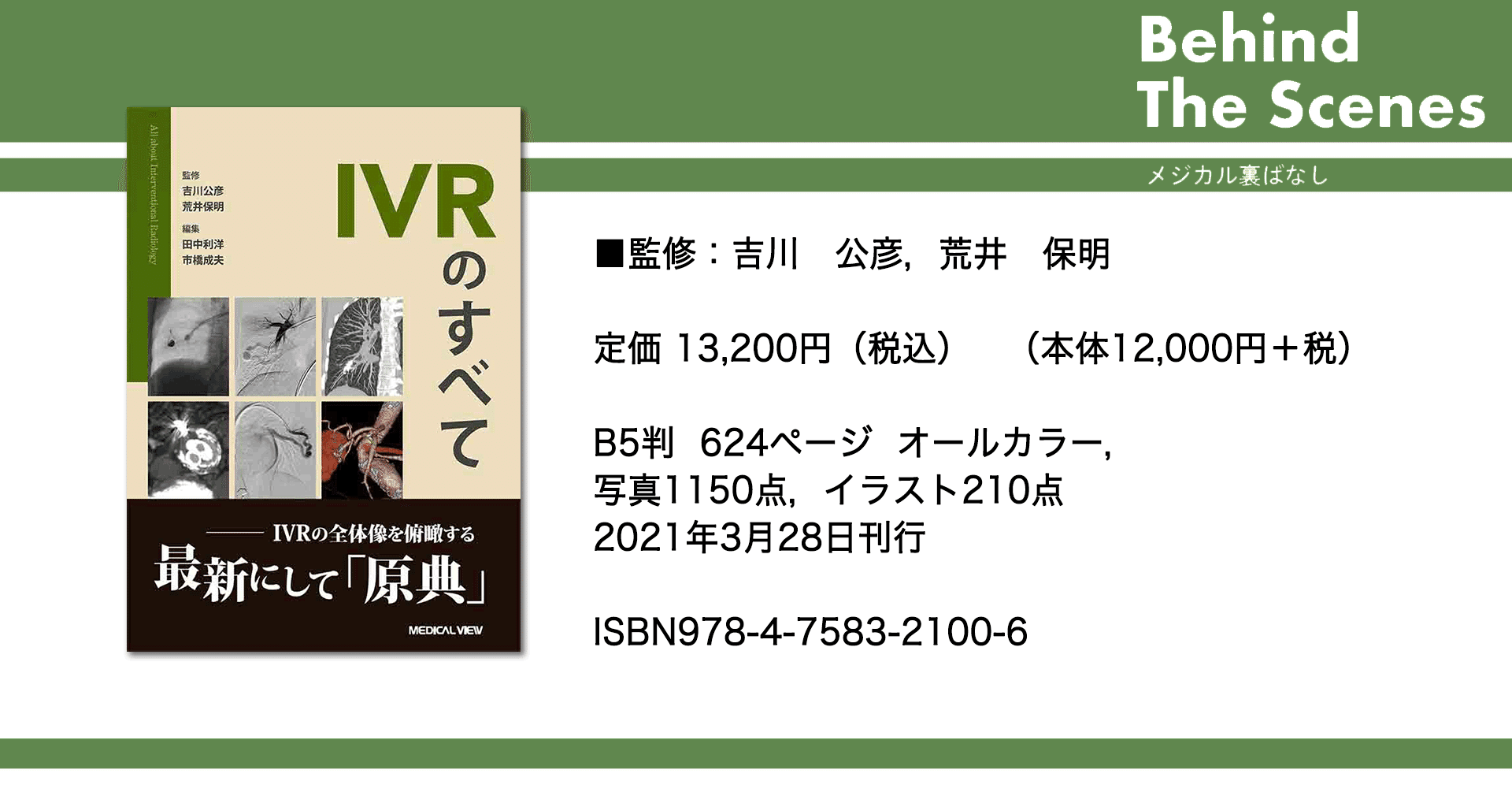 IVR 器材と手技・ポイント (MEDICAL VIEW)