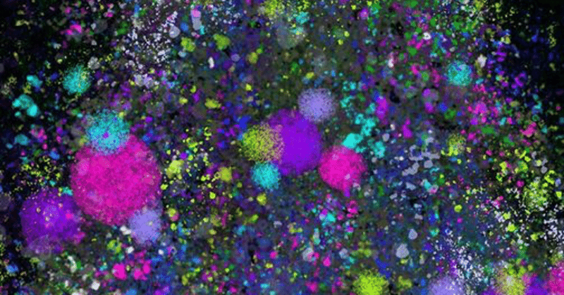 運命 の反対語は 自由 の話 タットヴァ Note