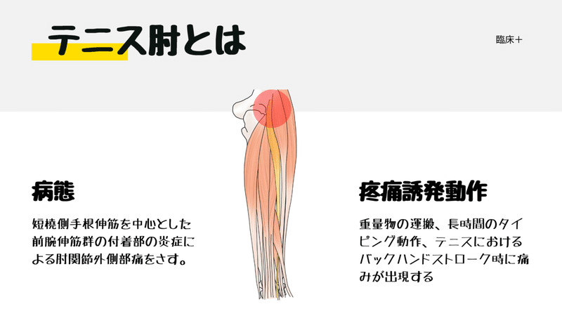 テニス肘改善のための手関節トレーニング (1)