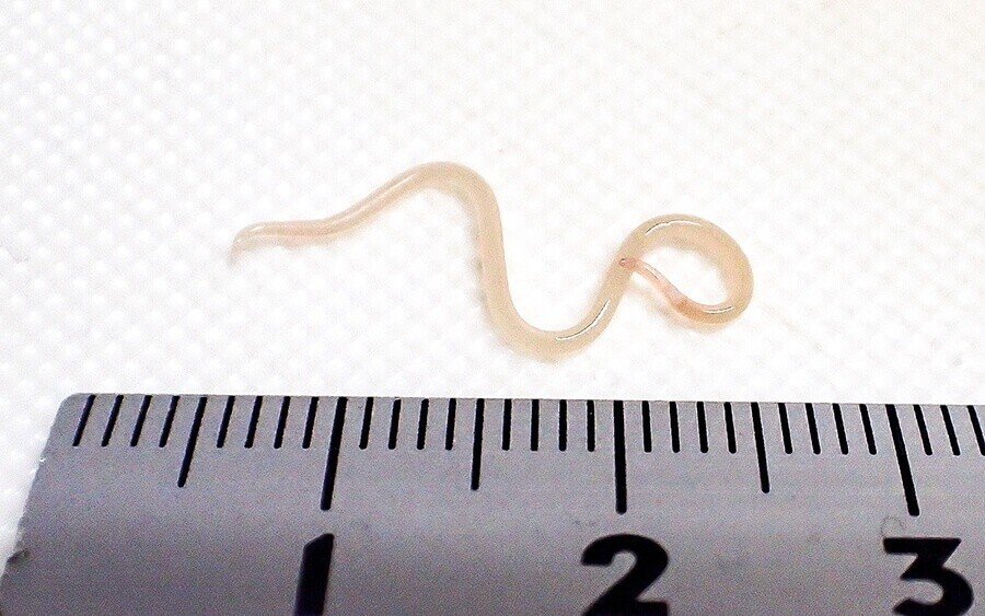 刺身にアニサキス 魚によくいる寄生虫6種とその対策 ブンイチ 文一総合出版 Note