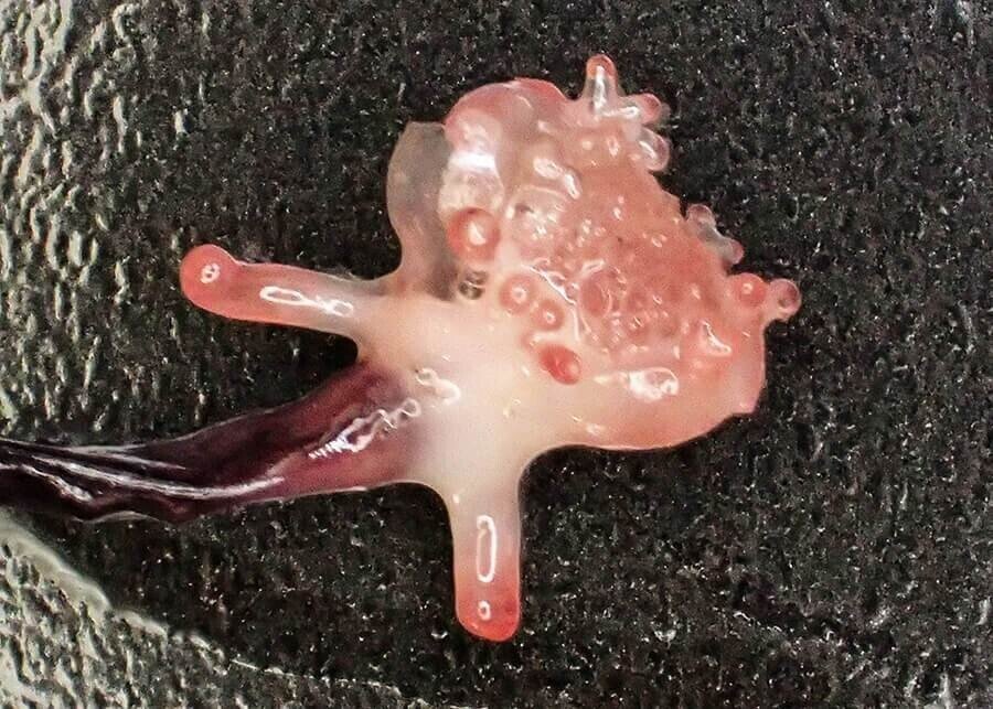刺身にアニサキス 魚によくいる寄生虫6種とその対策 ブンイチ 文一総合出版 Note
