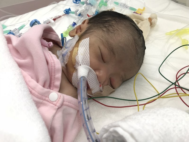 心臓に病気をもつ子の親になって あかり誕生から1週間の記録 成瀬 拓也 Note 心臓に病気をもつ子の親になって あかり誕生から1週間の記録 成瀬 拓也 Note