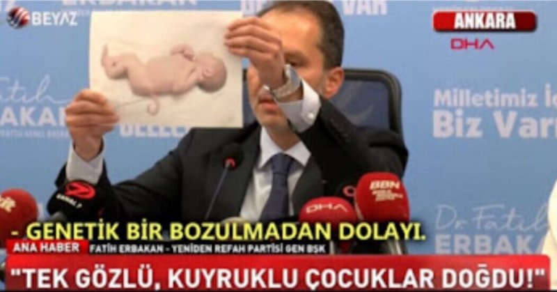 トルコで接種後に奇形児が生まれた はデマ 伊賀 治 デマ撲滅ファクトチェック集 Note トルコで接種後に奇形児が生まれた はデマ 伊賀 治 デマ撲滅ファクトチェック集 Note