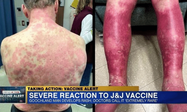 ダウンロード (2)