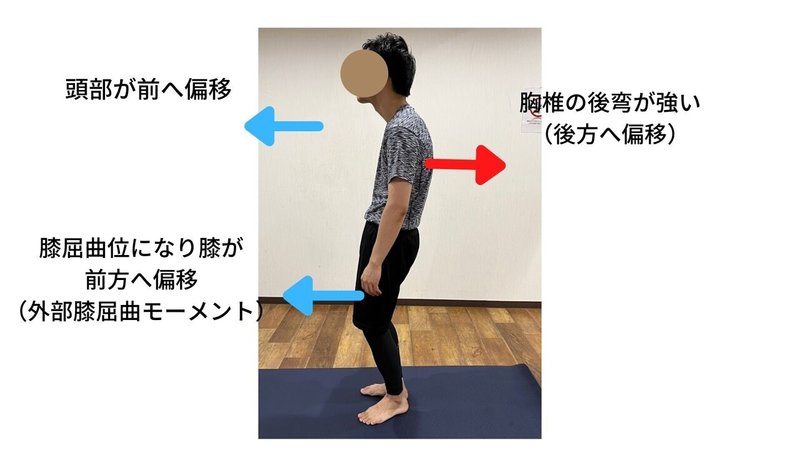 頭部が前へ偏移