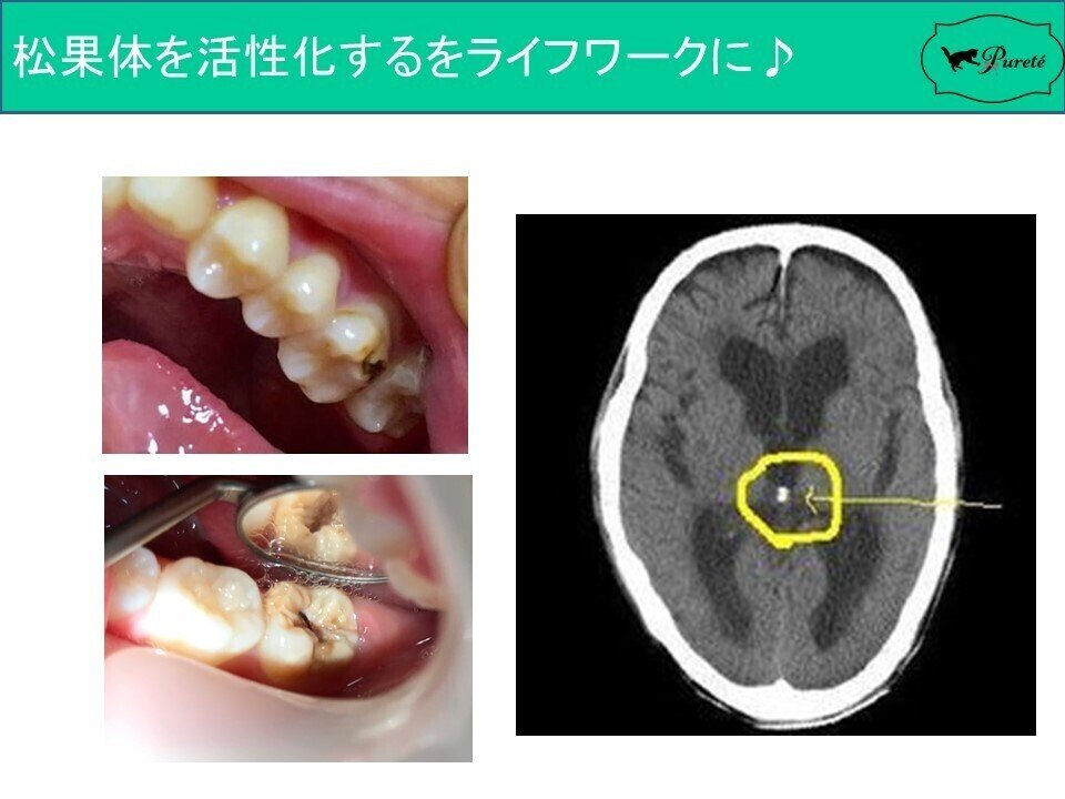 おしゃべり瞑想