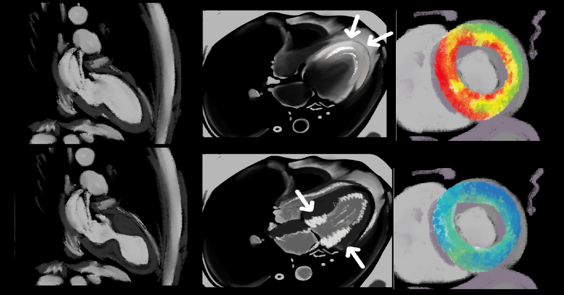 心臓疾患と撮像技術｜MRI認定試験対策ノート