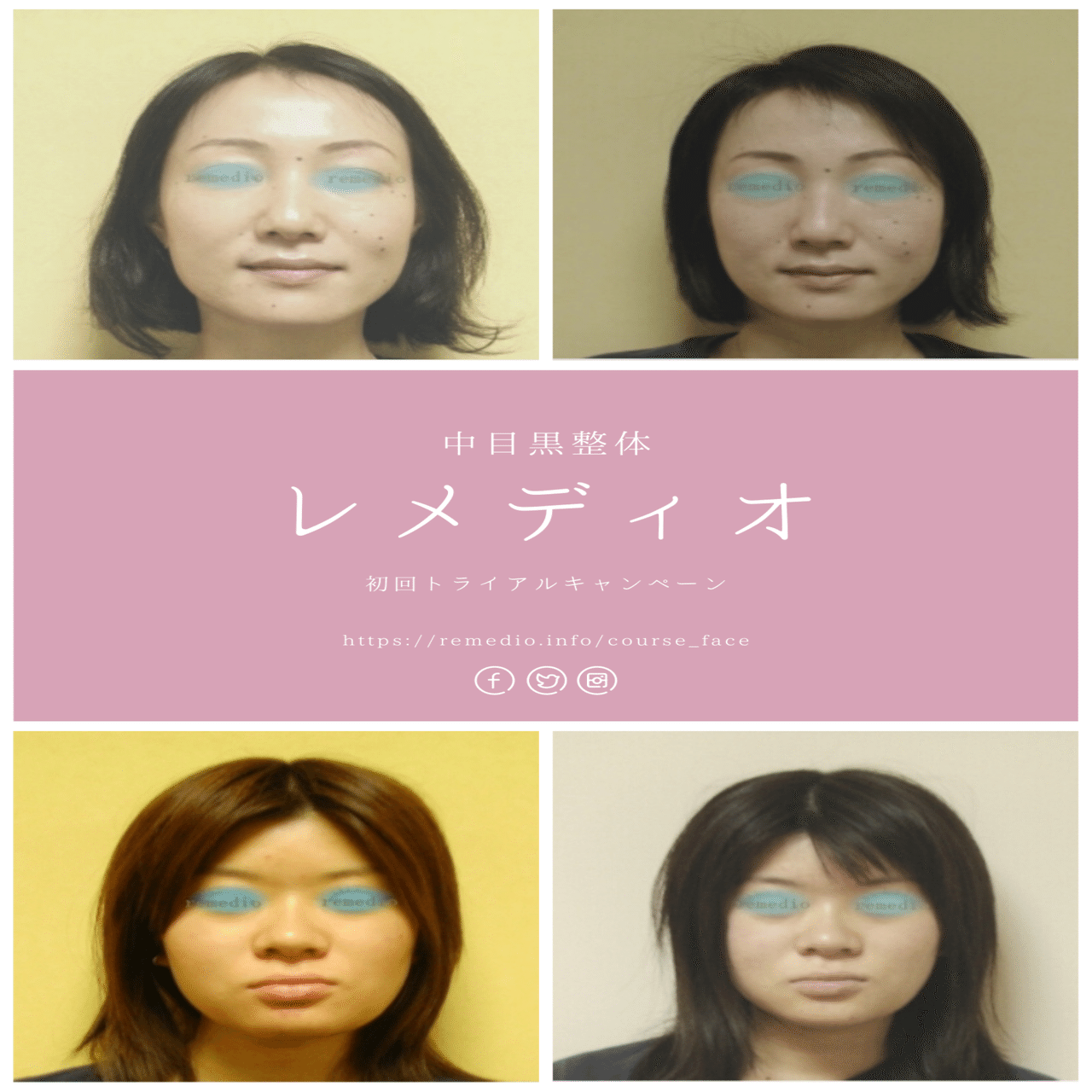 額を狭くする方法 自分で狭くする頭皮マッサージやり方 お顔の整体師 戸塚哲春 Note