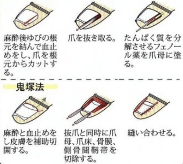 巻爪 Nail Salon Ruby